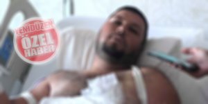 “Alıp kenara koymak istedim…  Ne olduysa o an oldu,  elimin koptuğunu gördüm…”