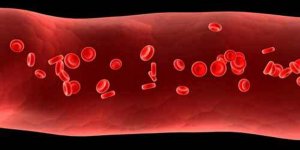 Vaskülit hastalığı nedir?