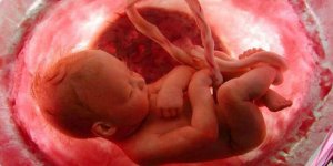 Antifosfolipid sendromu