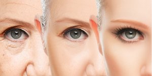 Cilt Kırışıklığı İçin Bakım Ürünü