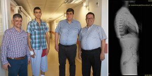 Devlet Hastanesi'nde skolyoz ameliyatları devam ediyor