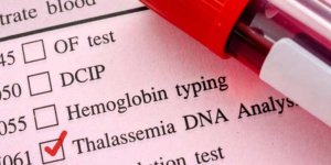 "Toplumun %16'sı taşıyıcı"