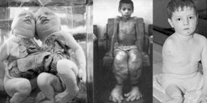 Güç Arzusuna Yenilmek: Çernobil ve Fukuşima’nın düşündürdükleri