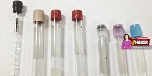 Tüp eksikliği Girne Akçiçek’te ‘tahlilleri durdurdu’