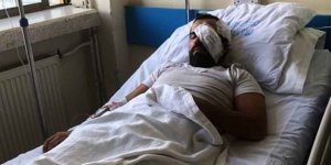 Basın mensubuna çirkin saldırı