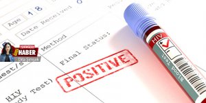 HIV’de korkutan artış: 2018’de 27, 2019’da 74 vaka tespiti!