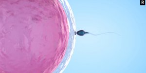 Azospermi Vakalarında Kök Hücre Tedavisi’nin Başarısı Nedir?