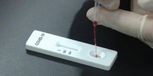 Tütün Endüstrisi'nin sonuçları negatif