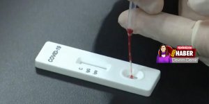 Test – vaka sayımız az, ölüm oranı yüksek