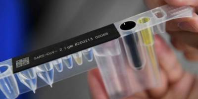 Alithia: "120 kişinin testleri iki aydır pozitif çıkıyor"