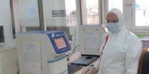 “Artış şimdi yoksa da, ilerleyen zamanda olabilir”