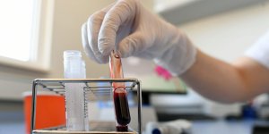 2 pozitif vaka daha, 3 taburcu