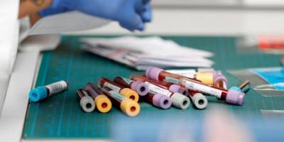 Tabiplerden PCR uyarısı: Kalite ve denetim şart