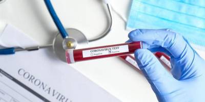 Geçitkale’de 2 pozitif, çok sayıda temaslı