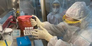 YDÜ'den umut veren proje